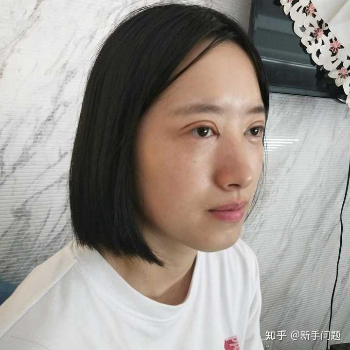 想知道有没有在福建省立医院丁力医生那里做过双眼皮的姐妹显示全部