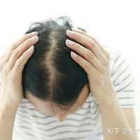 绝大多数体内激素水平是正常的,只是毛囊对雄激素不耐受,过于敏感而