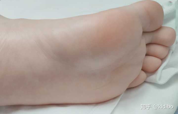 这样的脚可以当脚模吗?