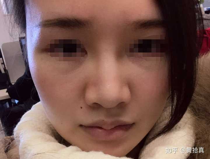 如何判断一个人是否整容过 知乎