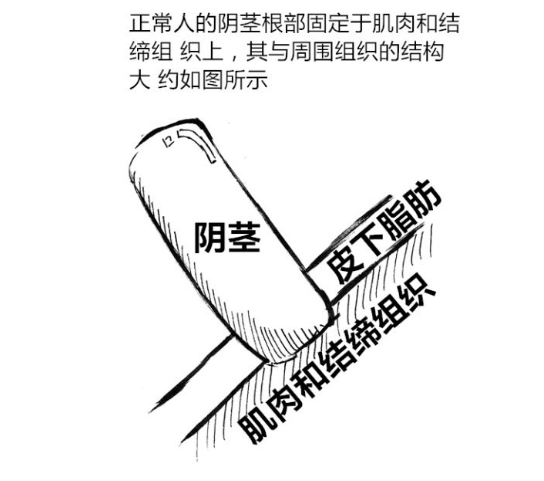 所谓的阿拉伯挤奶法有效吗?