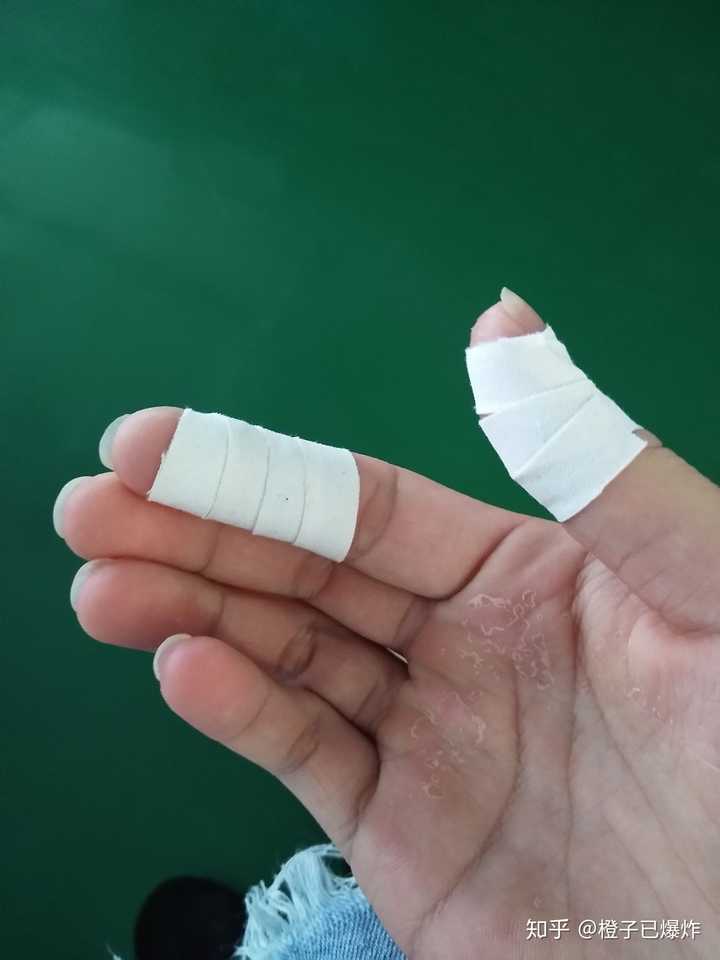 后来厂里的老人给了我白胶带缠住手指才好一点