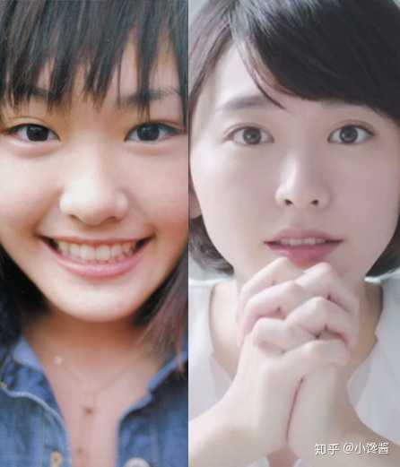 听说日本也有很多女星整容 为什么看起来日本女星整容比韩国的自然很多 但是好像国内很少有人去日本整容 知乎 听说日本也有很多女星整容 为什么看起来日本女星整容比韩国的自然很多 但是好像国内很少有人去日本整容 知乎