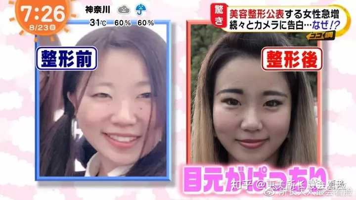 如何去日本整容 知乎