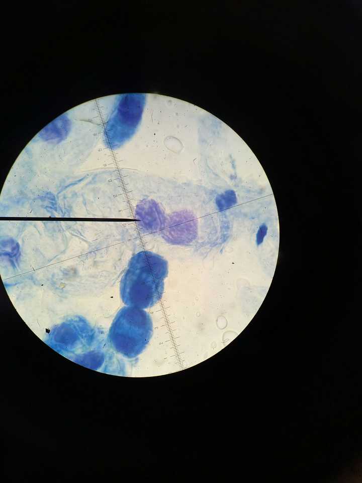 鸡血细胞的形态结构图片