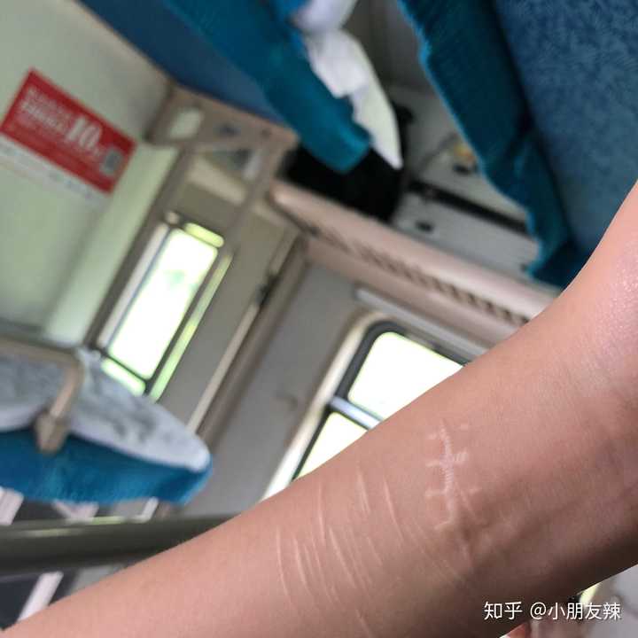 抑郁症怎么才能交到一个知心的朋友?