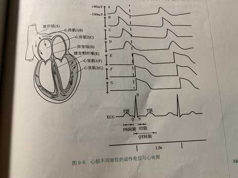 電流呈向下向左傳導,因此左側的電極(如i導聯,v5,v6導聯等)會