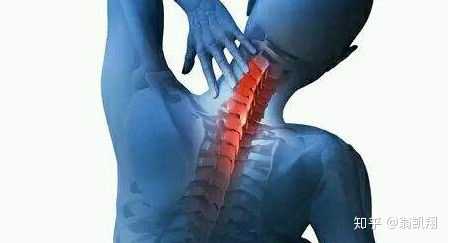 患颈椎病是怎样一种体验 知乎 患颈椎病是怎样一种体验 知乎