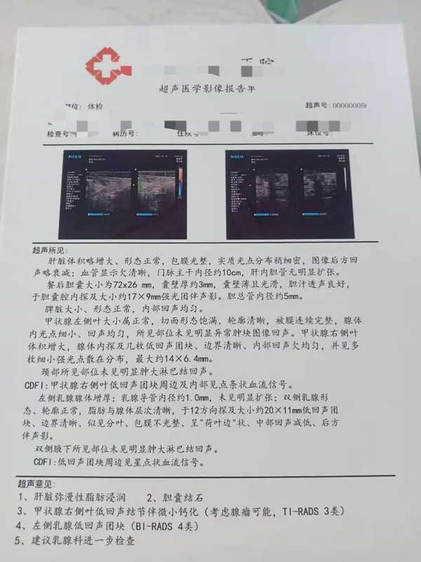 乳腺肿块，私立医院的医生建议我们去大医院详细检查。这是当时的报告单我本身是护士，看到报告单我就觉得不太好，但是对于乳腺方面不懂，于是