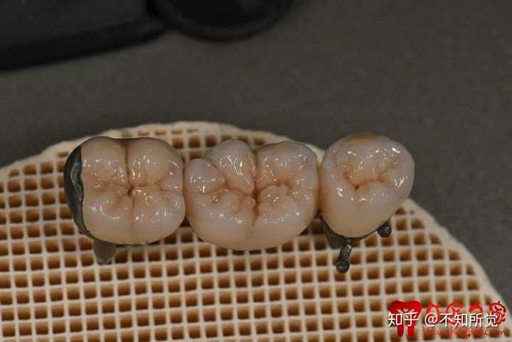 还是说这个东西在哪学都一样,车好牙形态,和对颌一样就行显示全部