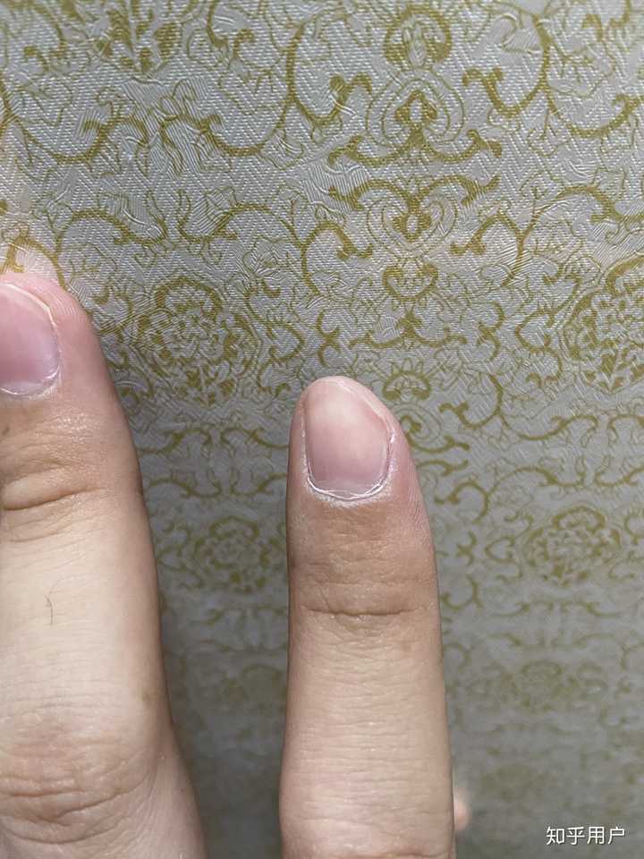切菜时切到手是一种什么样的体验? - 知乎