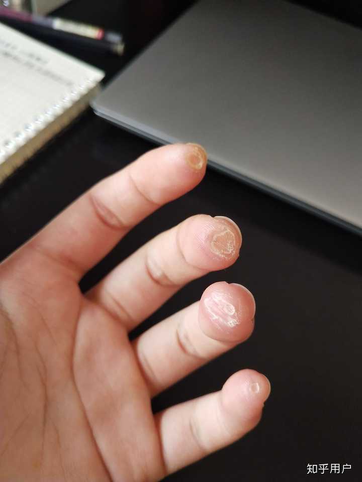 女生学吉他毁手吗?