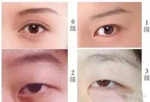 欧美人为什么嘲笑中国人眼睛小 知乎 欧美人为什么嘲笑中国人眼睛小 知乎