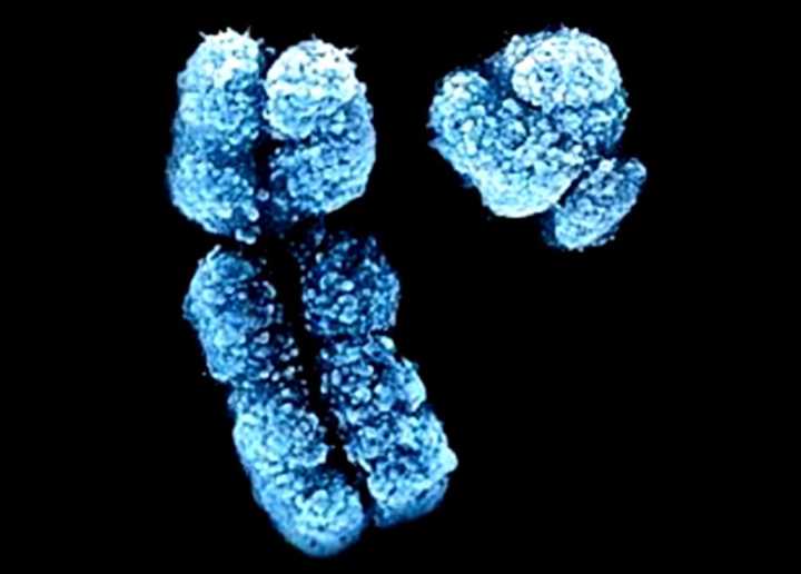 染色体结构变异显微镜图片