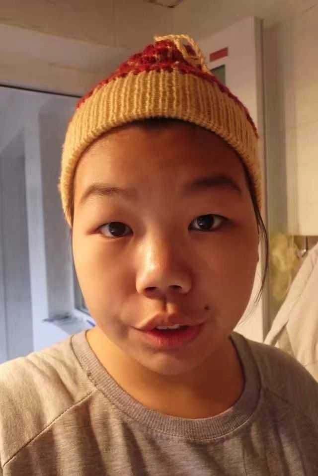 你是什么时候决定整容的?