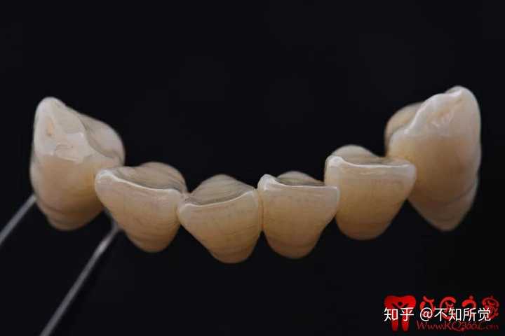 还是说这个东西在哪学都一样,车好牙形态,和对颌一样就行显示全部