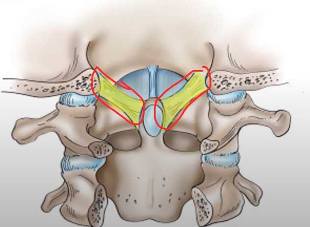 颈椎第一节也叫寰椎颈椎病里面有一类人是这个椎体出问题了典型症状是