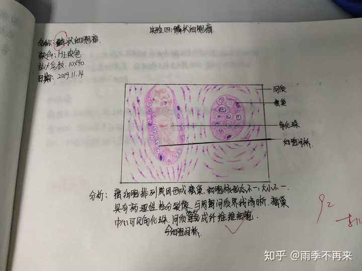 为什么咱们不弄个病理红蓝手绘图的问题呢?