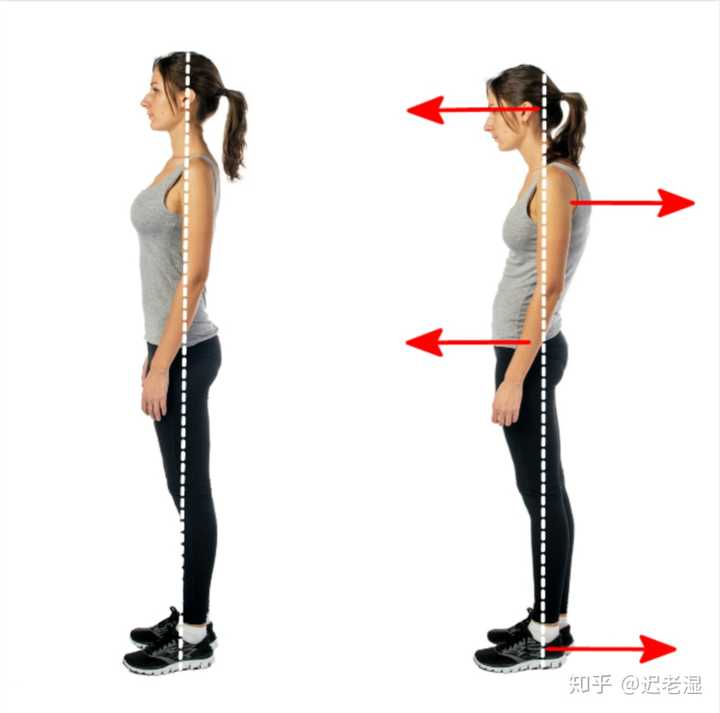 你们的颈椎不舒服是怎么缓解的?