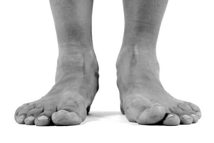 跑步两脚内侧肌肉感觉疼,鞋没有问题,换过好几双,怎么才能缓解?