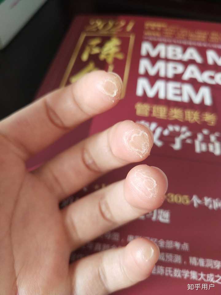 女生学吉他毁手吗?