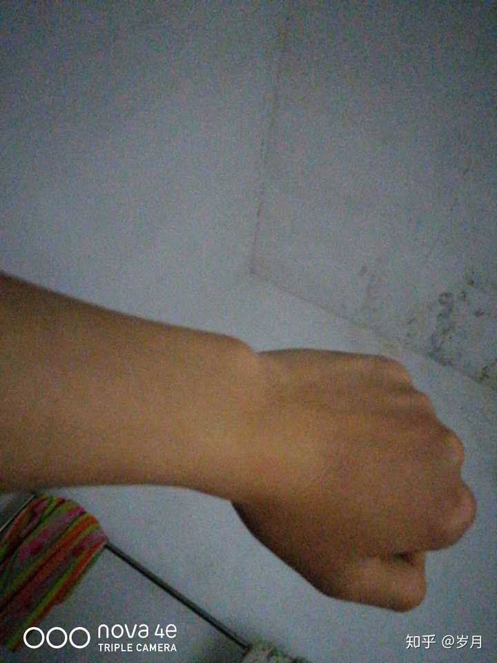 这这是我的手腕 170,99斤 你能谁能告诉我如何长胖啊