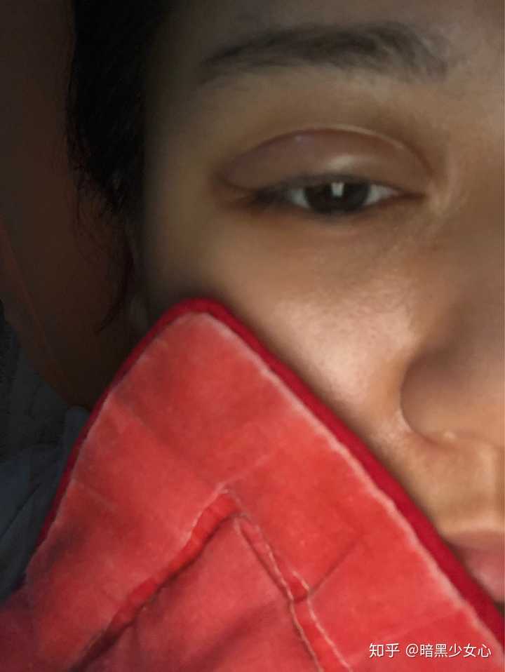 激光洗眼线痛吗?