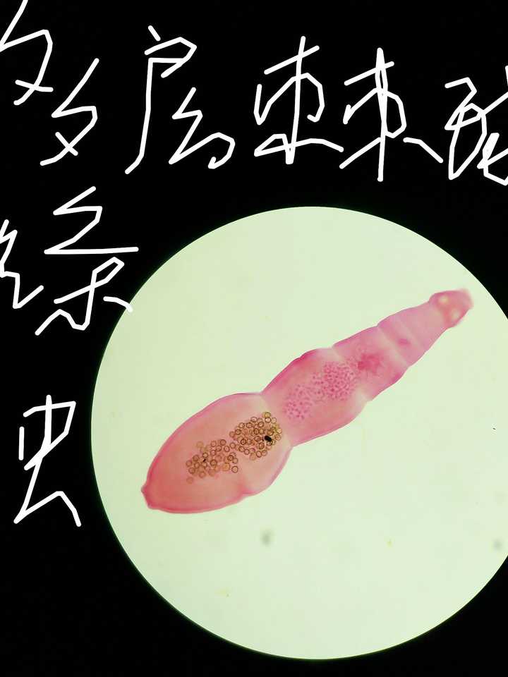 绦虫在显微镜下的图片图片