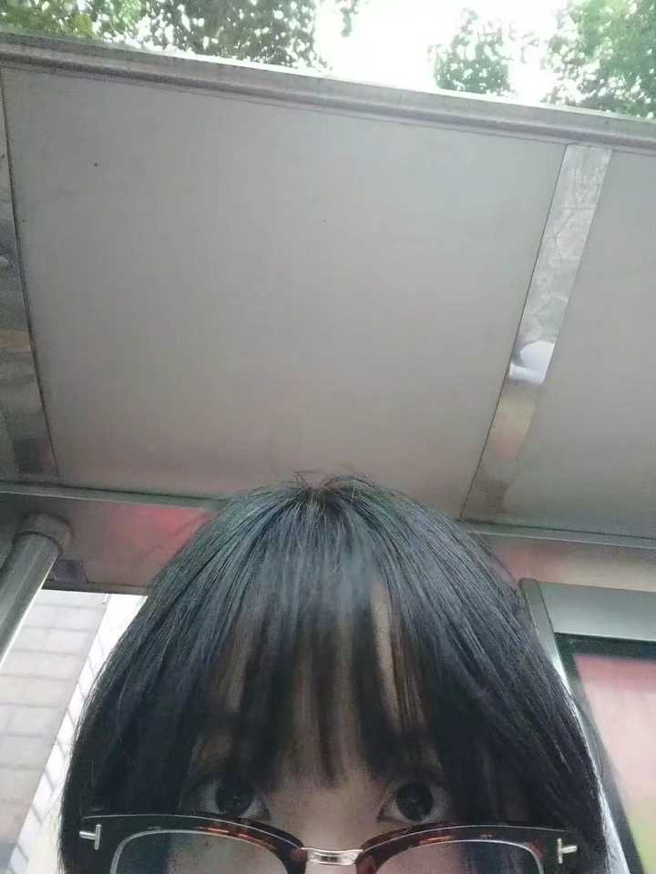 女生头顶头发少是什么体验 ?