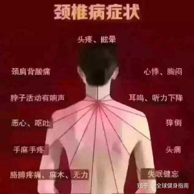 得了颈椎病有多痛苦 知乎 得了颈椎病有多痛苦 知乎