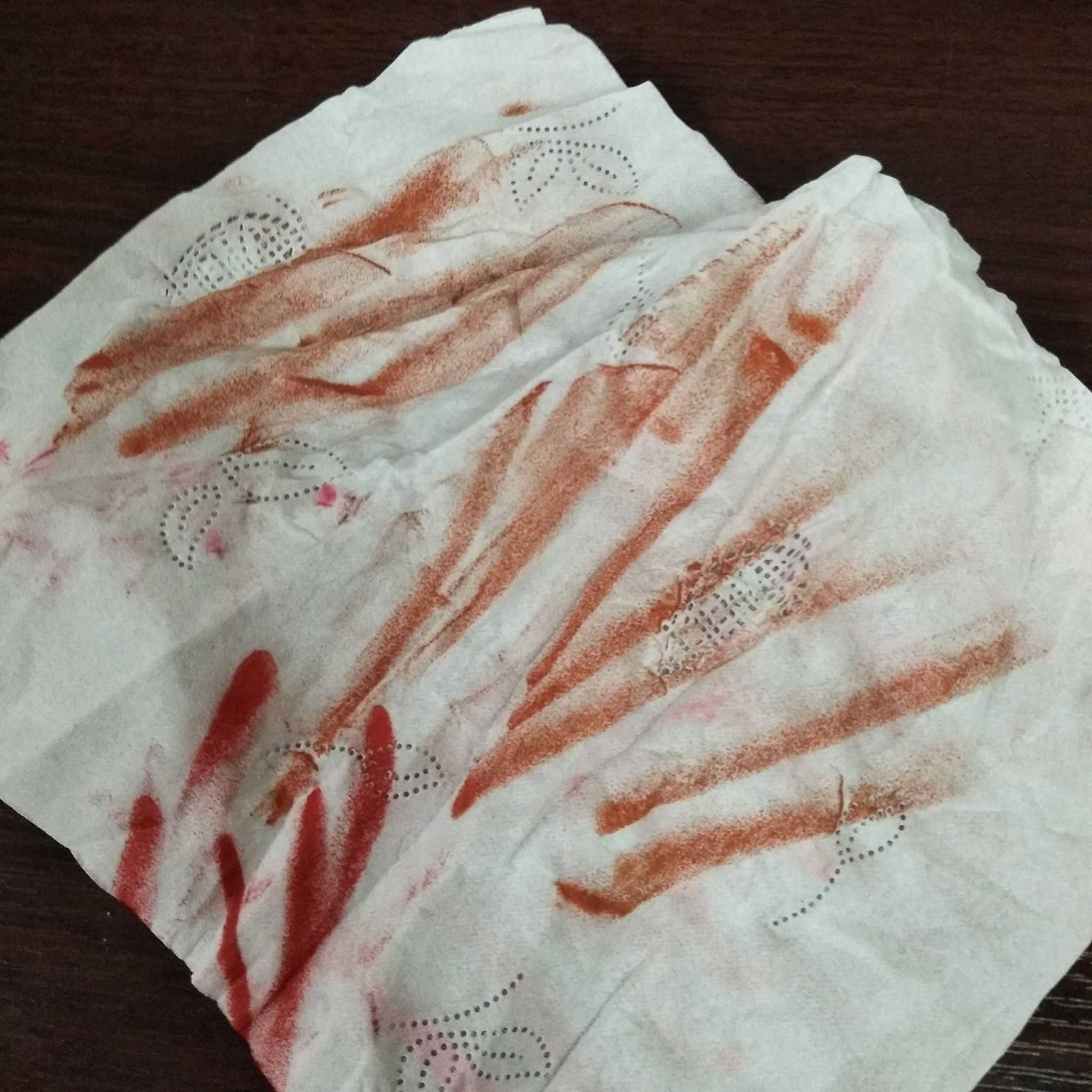 鼻血的纸巾图片