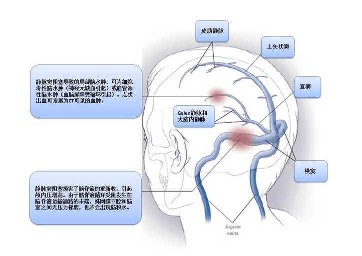 2018年2月1號 星期四 腦鳴是指延腦的耳蝸… - 知乎