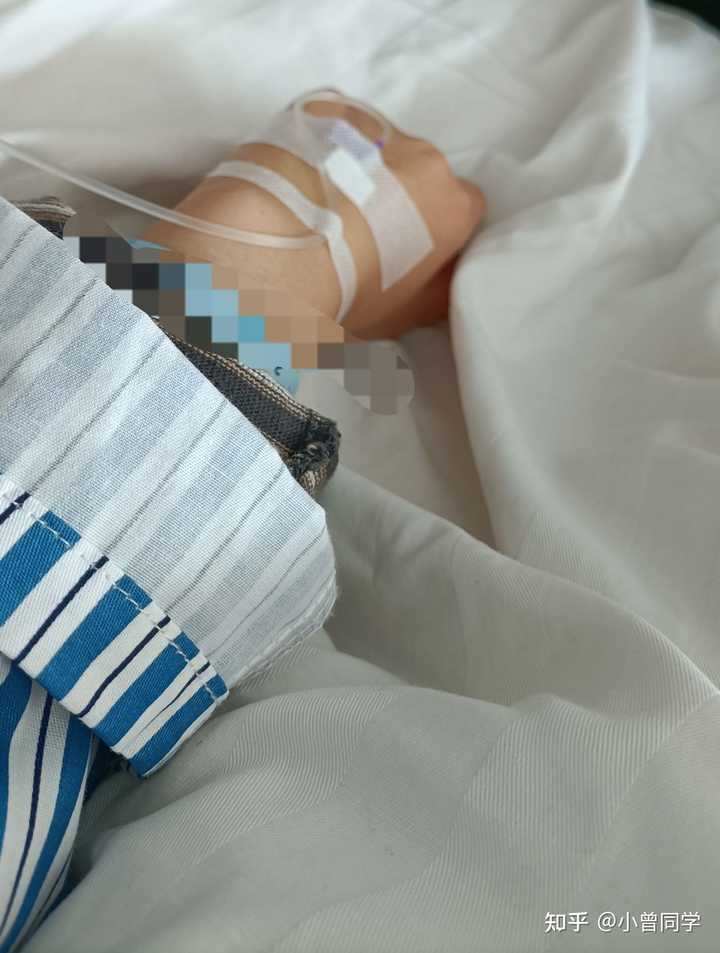 做 mect（无抽搐电疗）是种怎样的体验？