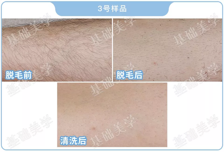 脱毛是用脱毛器还是脱毛膏好呢 知乎 脱毛是用脱毛器还是脱毛膏好呢 知乎