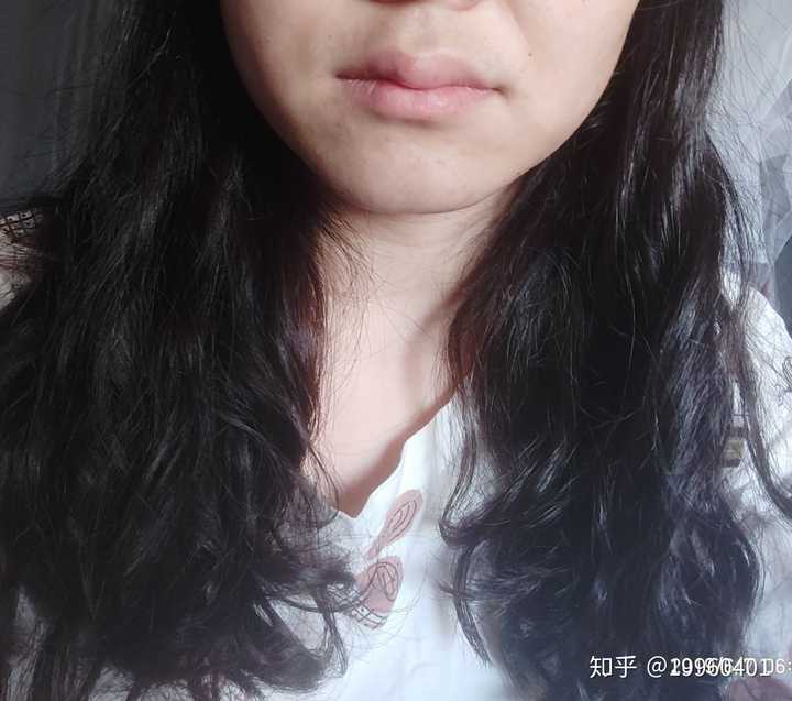 嘴唇上被咬到蚊子包是一种怎样的体验?