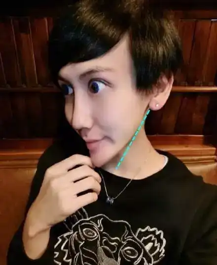 下颌角没有角度的,又会呈现出像刘宝宝这样的蛇精脸,一样不好看