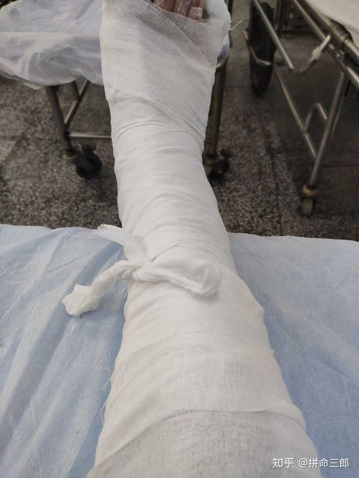 腿摔了在医院的照片图片