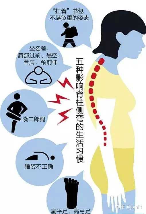 小弟今年20岁,脊椎侧弯c型43度,其实不影响我什么只是高低肩这个问题