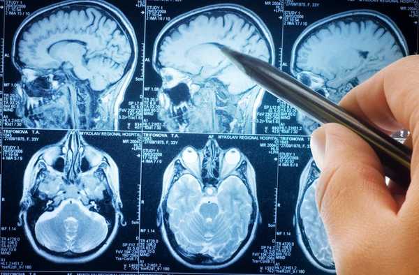 人脑有哪些现在尚无法用科学解释的神奇功能？