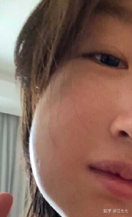 如何鼓起勇气拔智齿?