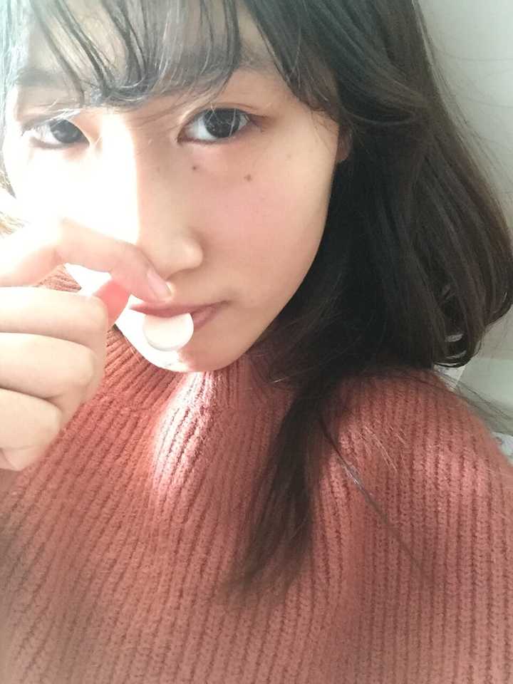 右眼下的四科痣长连起来了