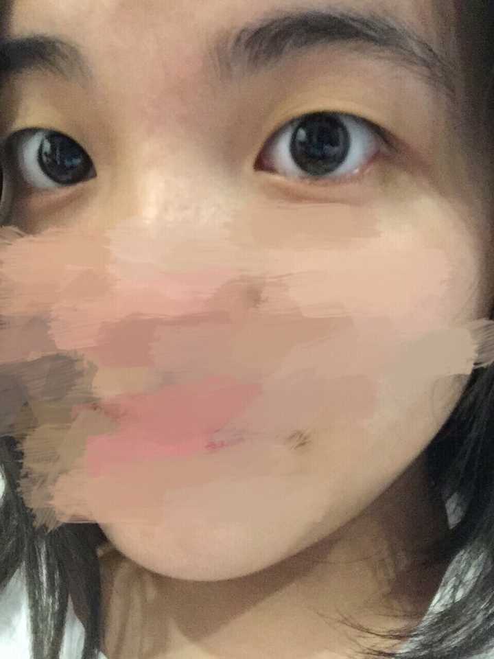 大眼睛有单眼皮的吗?怕是少得如国宝级了吧!