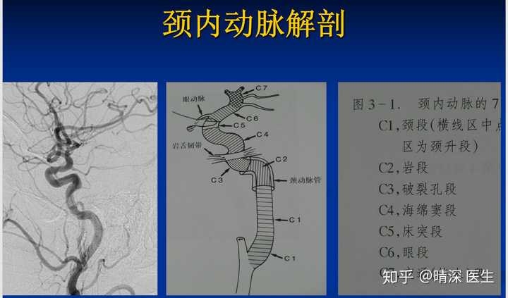 前交通动脉位置图片