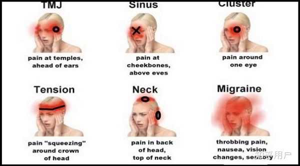 why-does-my-head-hurt-causes-symptoms-treatment-headache-by