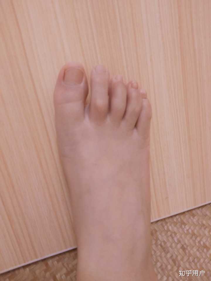 女生脚丑是种什么样的体验?