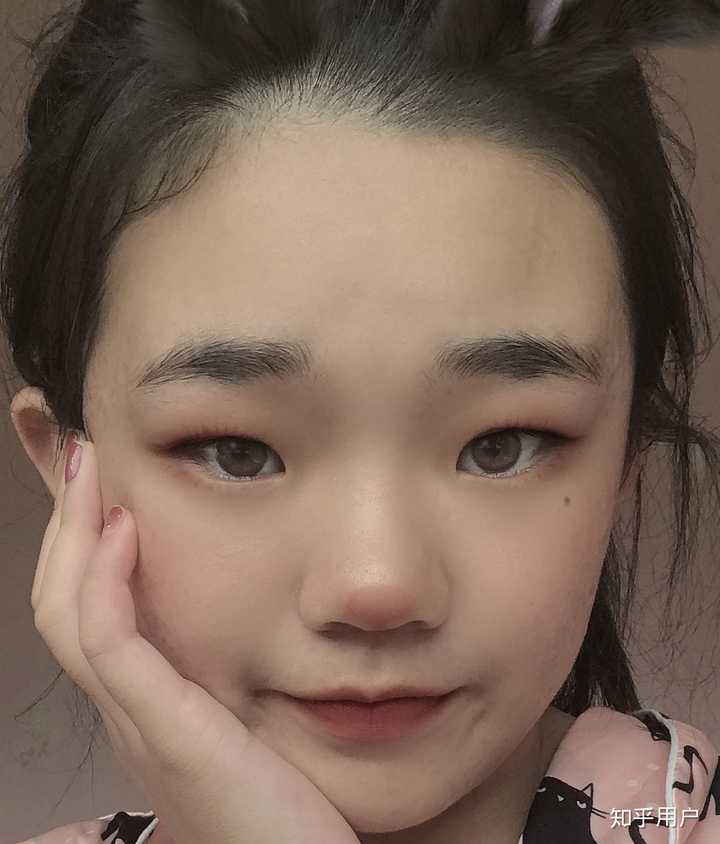 单眼皮 塌鼻子 鼻翼也很大一一点也不小巧 但却不丑