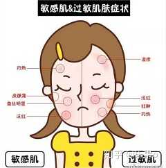 敏感皮肤怎么护理