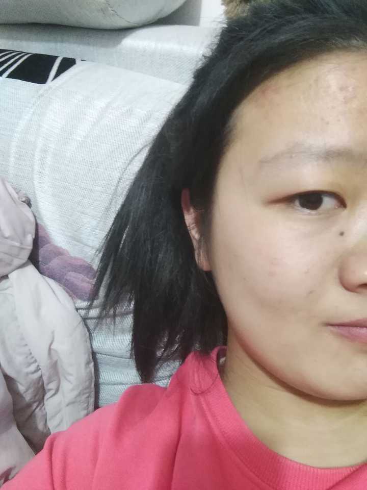左右脸不对称的人自拍是怎样一种体验?