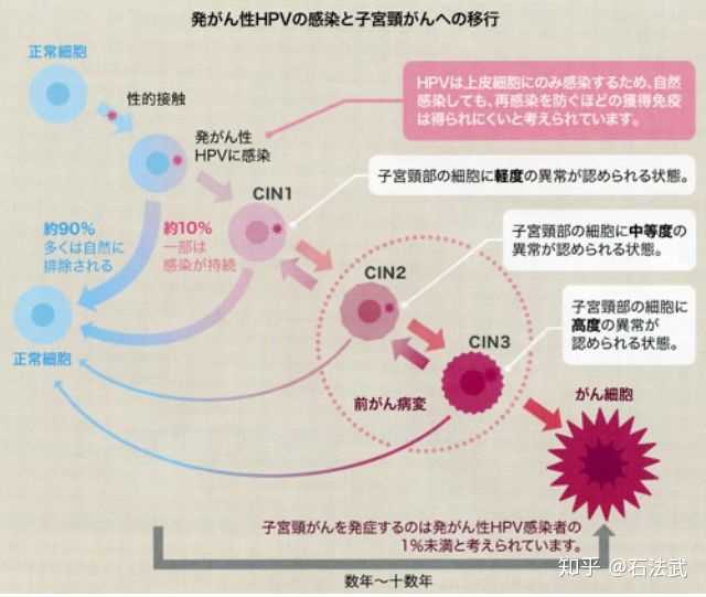 感染 hpv 病毒就一定會得宮頸癌嗎?