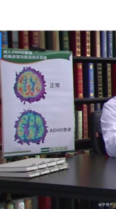 有没有成人adhd 的朋友能讲讲自己的感受经历 知乎